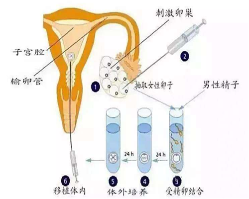 广西借卵三代试管移植成功率高吗？2026广西三代借卵生男孩医院推荐						,代生机构